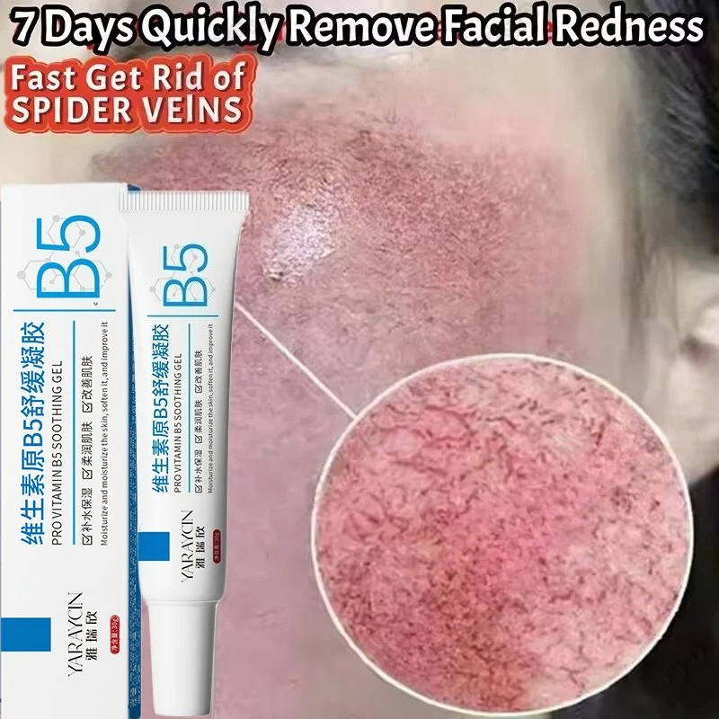 Ceramide Moisturizer - Facial Redness Repair Cream Improve Sensitive
