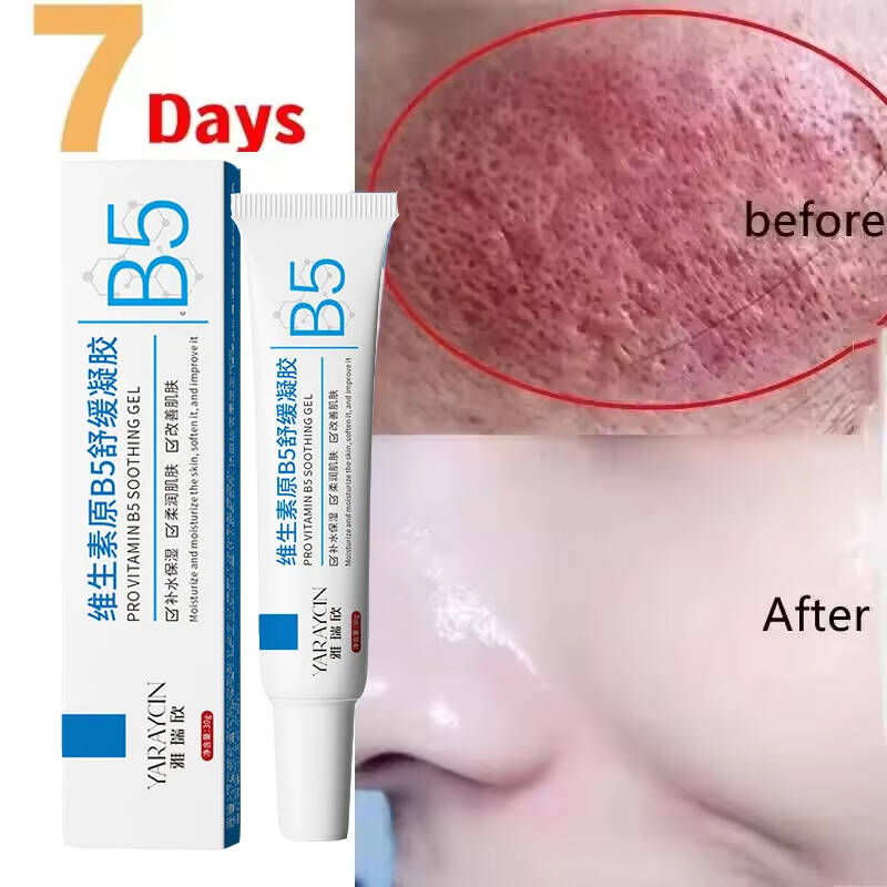 Facial Redness Repair Cream Im - Ceramide Moisturizer recension och pris