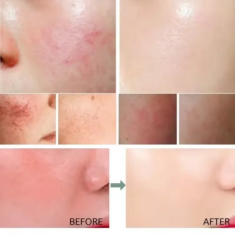 Facial Redness Repair Cream Im - Ceramide Moisturizer recension och pris